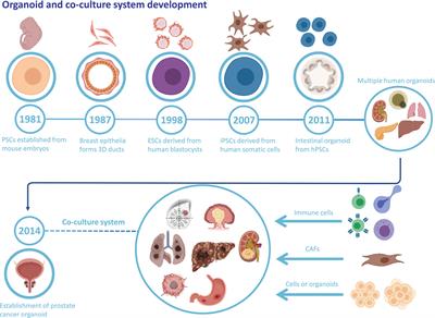 Cancer organoid co-culture model system: Novel approach to guide precision medicine